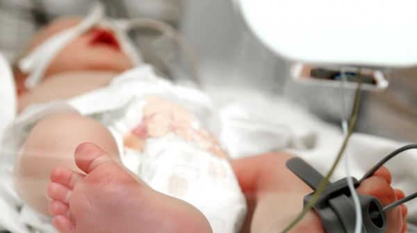 Аномалии развития кишечника у новорожденных