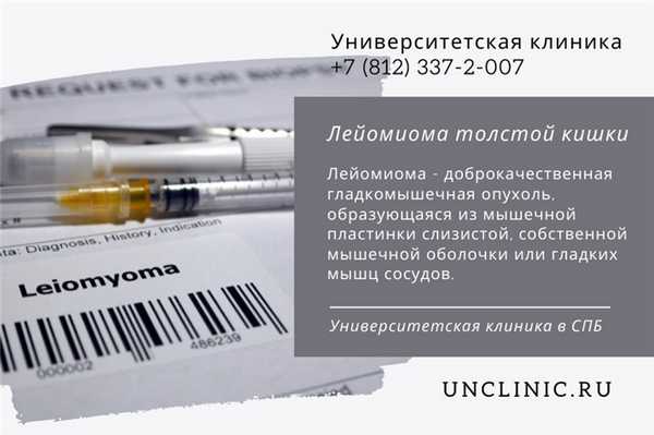 Лейомиома - доброкачественная гладкомышечная опухоль, образующаяся из мышечной пластинки слизистой, собственной мышечной оболочки или гладких мышц сосудов