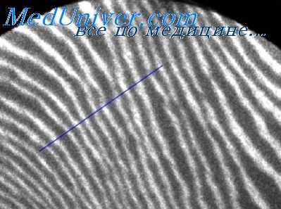 радиационные поражения