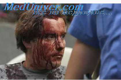 сепсис у больного