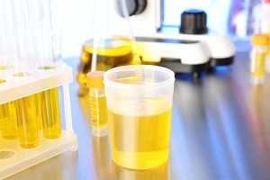 Анализ мочи на эстрогены и их метаболиты