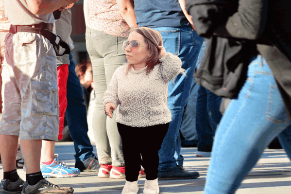 Аномально низкий рост человека