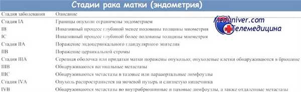 Стадии рака матки - эндометрия
