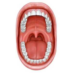 Рак полости рта