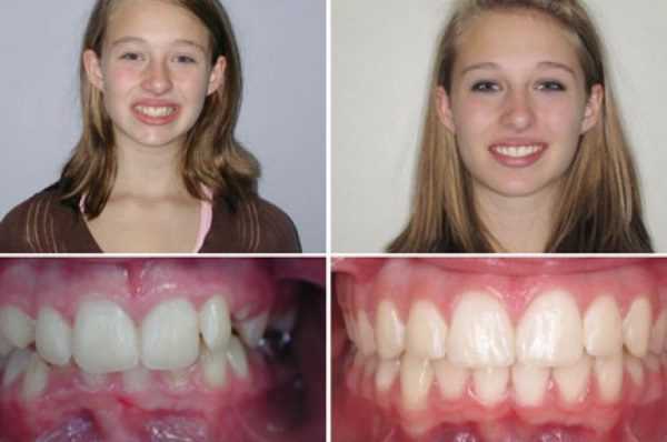 Результат коррекции