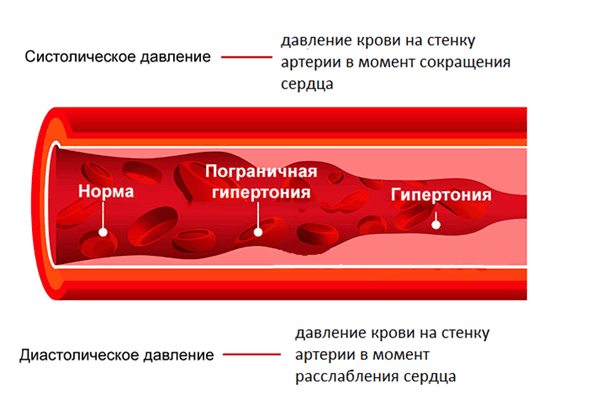 картинка давление на стенку.png