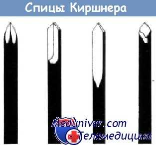 Спицы Киршнера