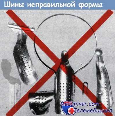 Неправильные шины для иммобилизации предплечья и кисти