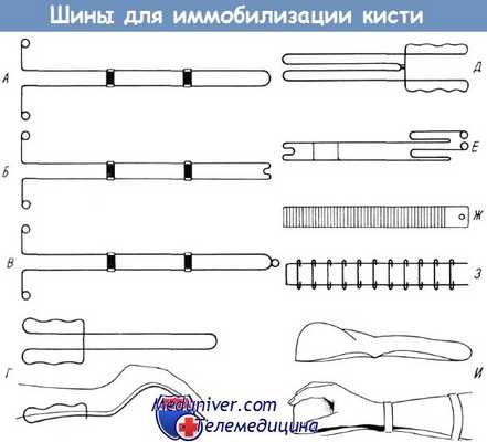 Шины для иммобилизации кисти