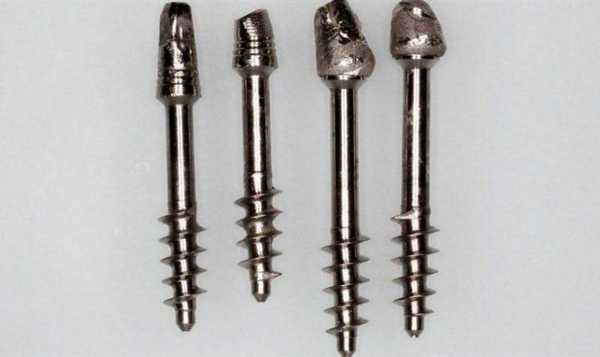 Базальные импланты