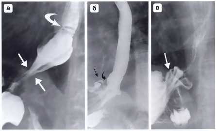 Рис. 5. Рентгенограмма. 