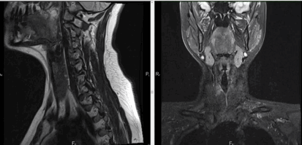 Магнитно-резонансная томография указанной области