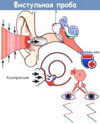 Фистульная проба
