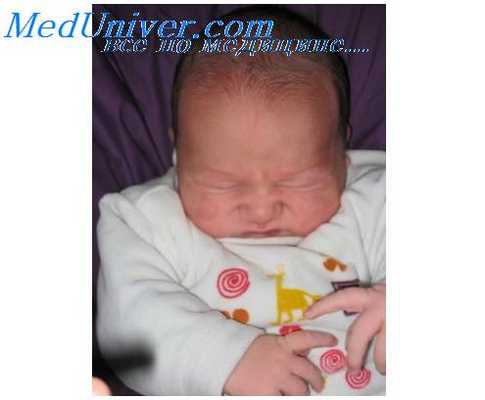 ишемия миокарда у новорожденных