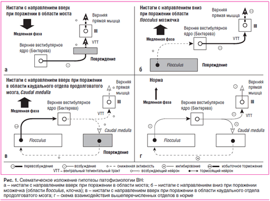Рис. 1. Схематическое изложение гипотезы патофизиологии ВН