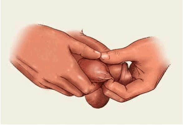 Самообследование яичек