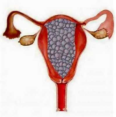 трофобластическая болезнь