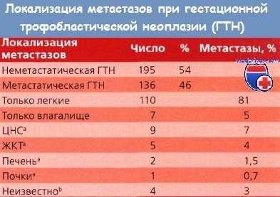 Локализация метастазов гестационной трофобластической неоплазии (ГТН)