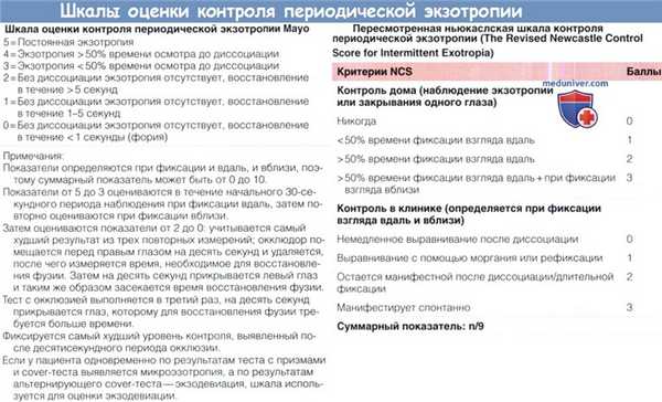 Шкалы оценки контроля периодической экзотропии - Ньюкаслская и Мейо