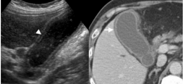 Снимок экрана 2016-04-20 в 21.52.54