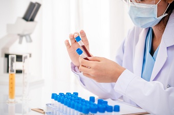 Клинический анализ крови