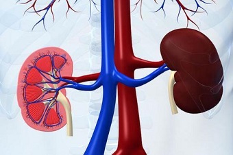 Тромбоз почечных вен