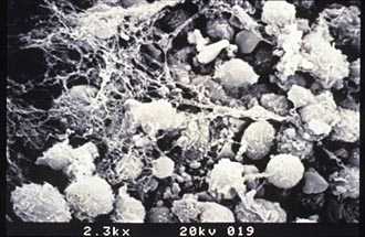 Колонии стволовых кроветворных клеток (электронная микроскопия)