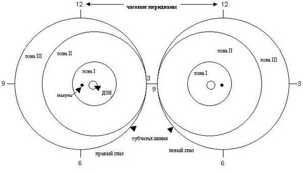  Изображение локализации и протяженности ретинопатии недоношенных