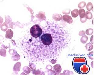 костный мозг - макрофаг