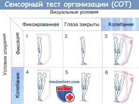 Сенсорный тест организации (СОТ)