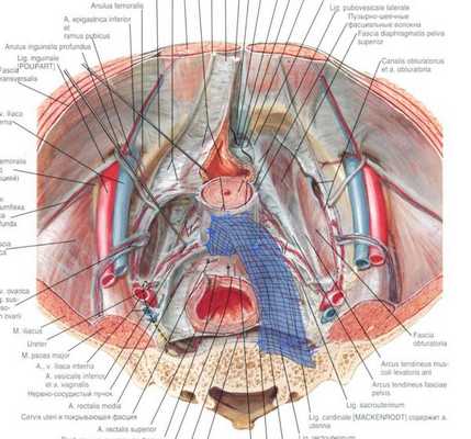 Ректосакропексия