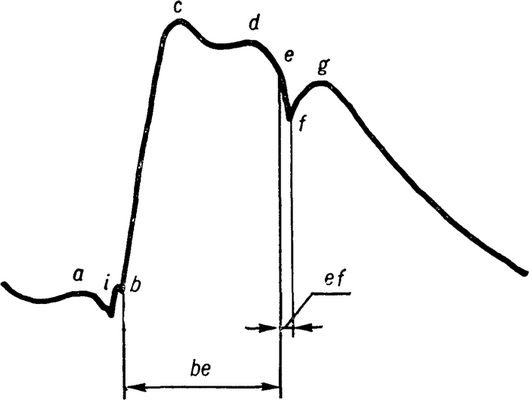 Рис. 1. Сфигмограмма сонной артерии в норме: а — предсердная волна; в — с — анакрота; с — f — катакрота; d — поздняя систолическая волна; е — f — g — инцизура; g — дикротическая волна; i— преданакротический зубец; be — период изгнания; ef — протодиастолический интервал.