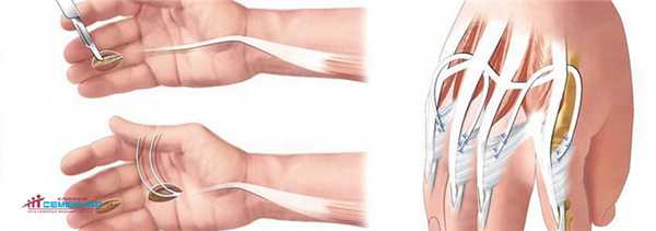 Микрохирургия, реконструктивная хирургия и хирургия кисти