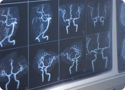 МРА (магнитно-резонансная ангиография)