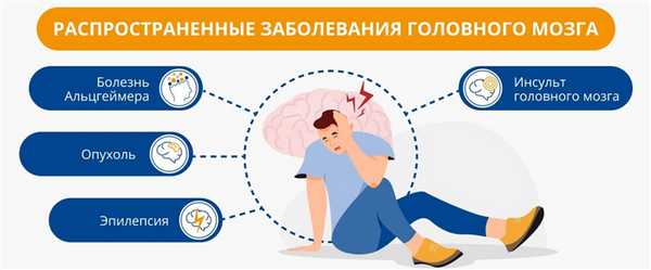 Распространенные заболевания головного мозга