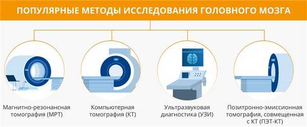 Популярные методы исследования головного мозга