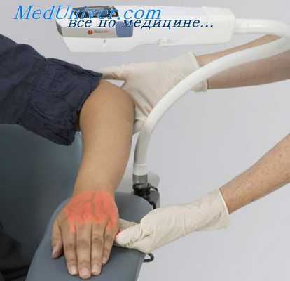 катетеризация артерий