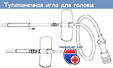 Тупоконечная игла для головы