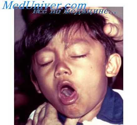 профилактика заболеваний