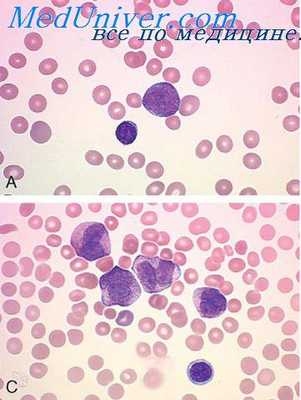 механическая асфиксия