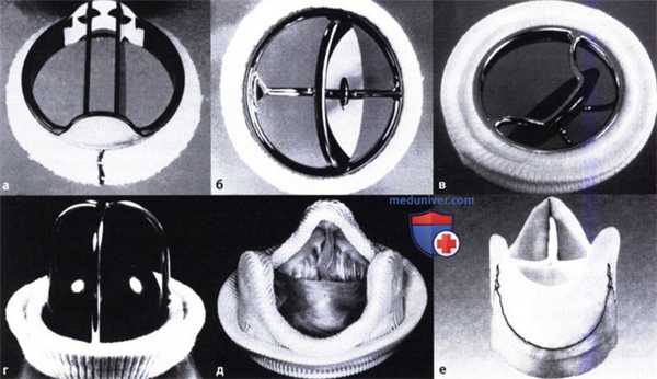 Механические протезы клапанов сердца