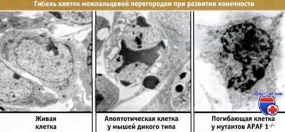 Гибель клеток межпальцевой перегородки при развитии конечности
