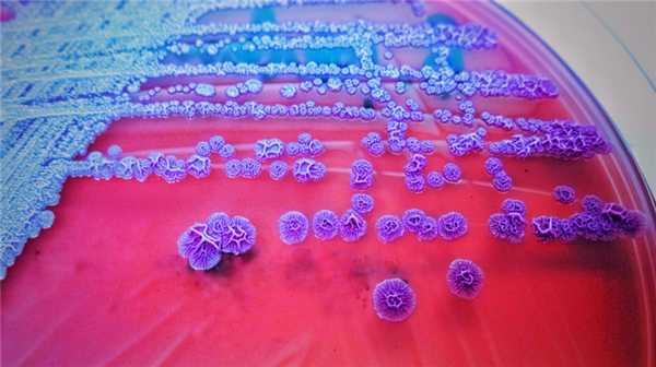 Мелиоидоз и его возбудитель