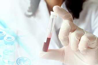 Анализ на антиядерные антитела