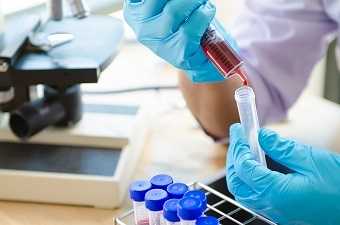 Анализ крови