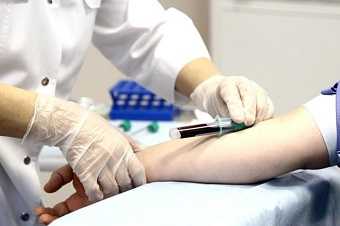 Забор крови из вены