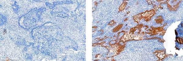 анализ на экспрессию p53