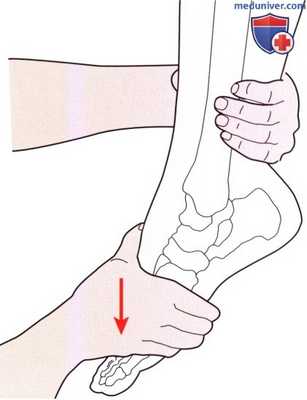 Исследование пассивных движений в голеностопном суставе и стопе