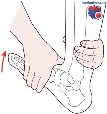 Исследование пассивных движений в голеностопном суставе и стопе