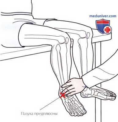 Пальпация голеностопного сустава и стопы с тыльной стороны